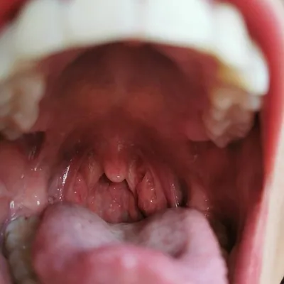 @i_love_uvula profile image