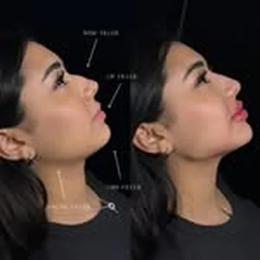 @natural_facial_contouring profile image